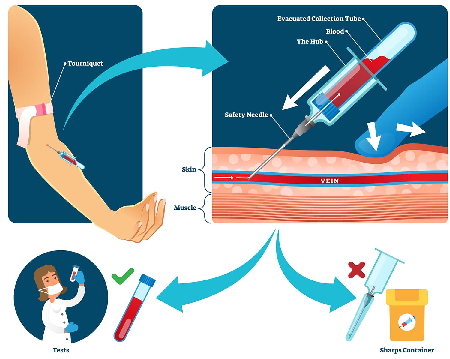 Learning Phlebotomy Equipment Arizona College